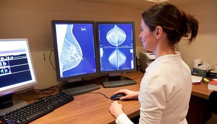 aplicación de mamografía