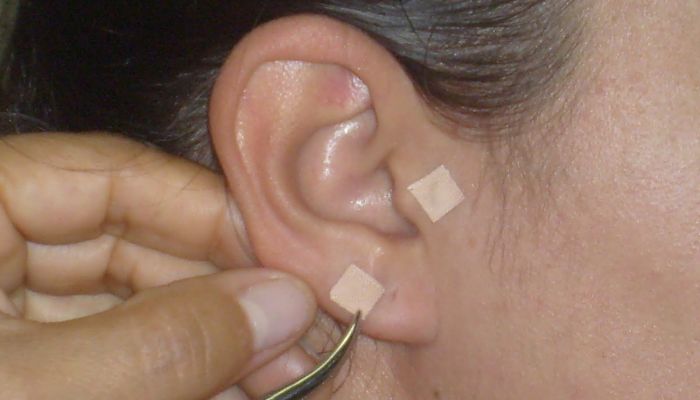 Puntos de acupuntura en la oreja para dejar de fumar 
