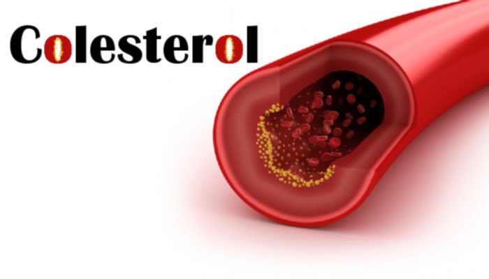 El colesterol y la diabetes