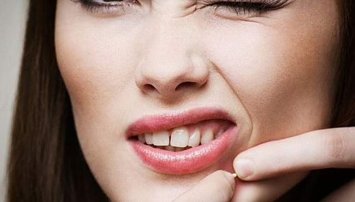 ¿ Cómo Quitar Las Espinillas De La Cara ? Remedios Naturales y Efectivos