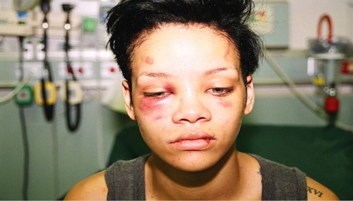 Rihanna golpiza