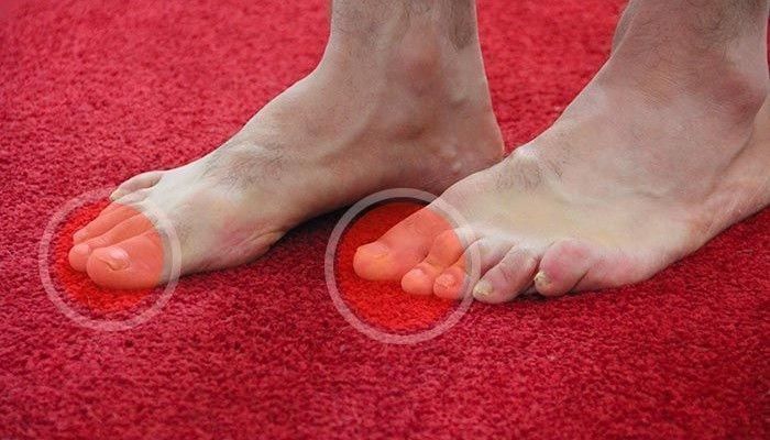 ácido bórico para los pies sin hongos