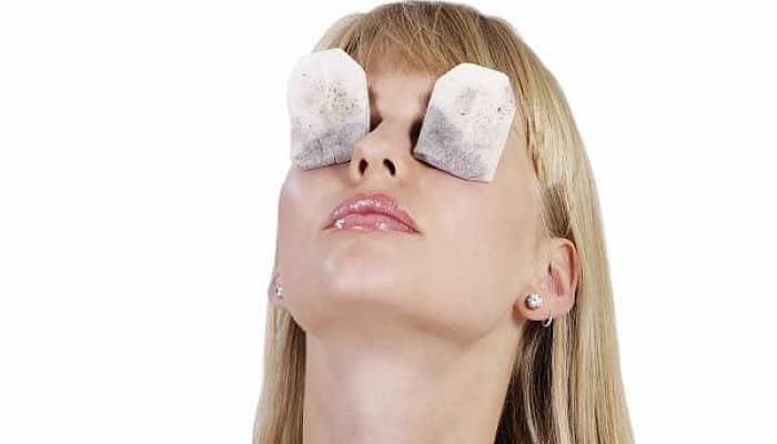 Remedios Caseros Para Ojos Secos Tratamientos