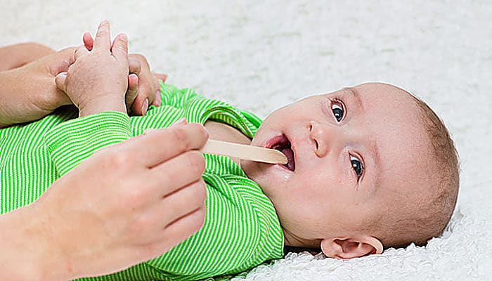Amigdalitis en los bebés