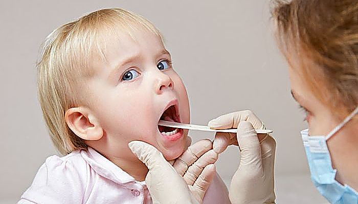 Se comprueba a fondo la garganta para detectar todos los signos de Amigdalitis en los bebés