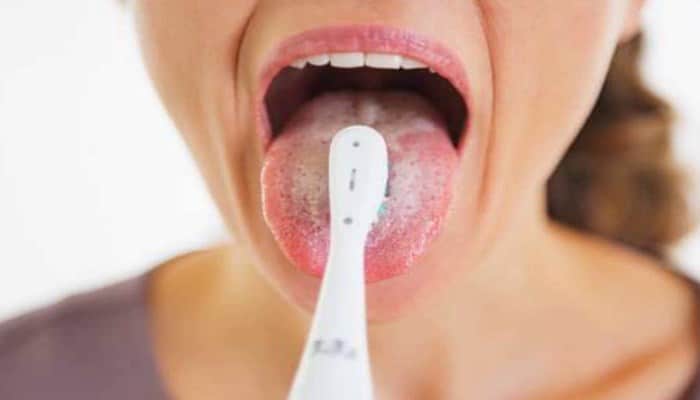 higiene en la lengua