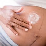 Problemas en la piel durante el embarazo
