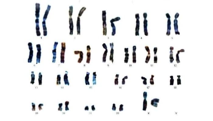cromosoma 18