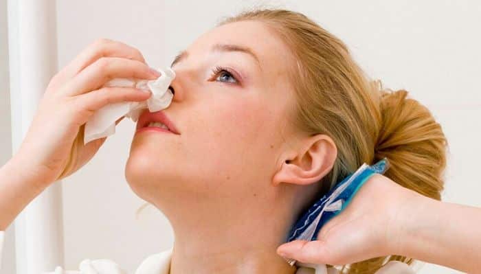 las hemorragias nasales provienen de los capilares en la parte delantera de la nariz. Debido a que una ingesta adecuada de vitamina C disminuye 