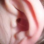 Presión En Los oídos
